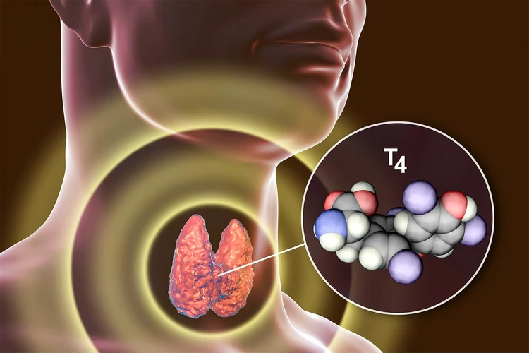 Xét nghiệm máu Thyroxine (T4) là gì?