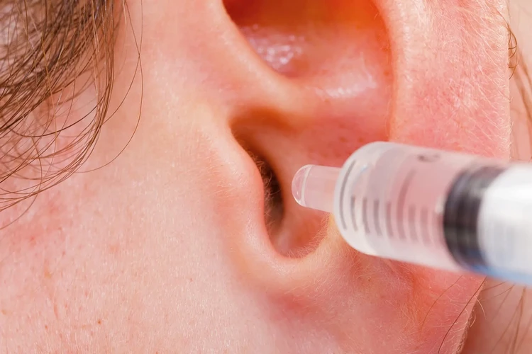 Cách vệ sinh tai của bạn