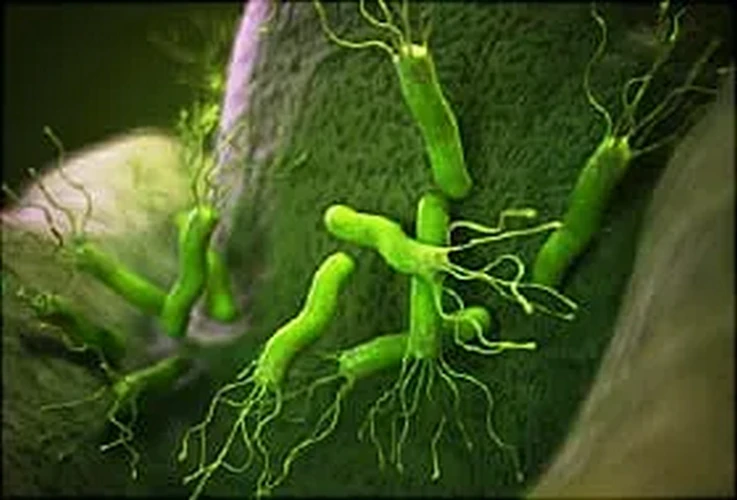 H. Pylori và ung thư dạ dày