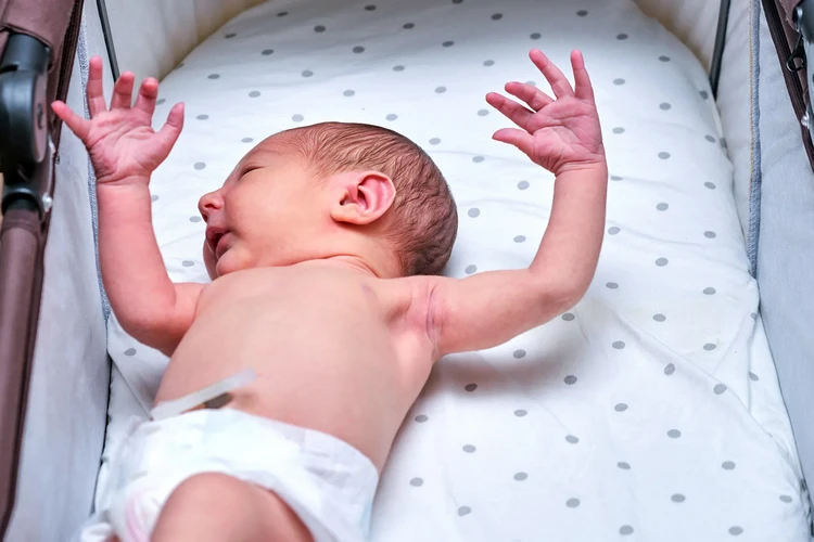 Phản xạ Moro là gì?
