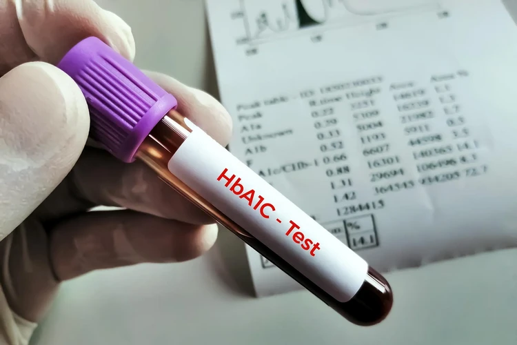 Hemoglobin: Xét nghiệm A1C, Phạm vi và Mức bình thường