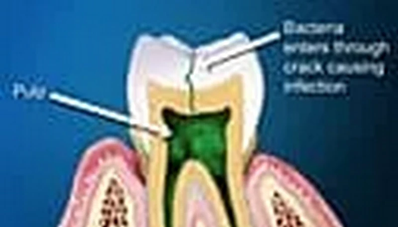 Sức khỏe răng miệng: Những dấu hiệu cảnh báo bạn không bao giờ nên bỏ qua