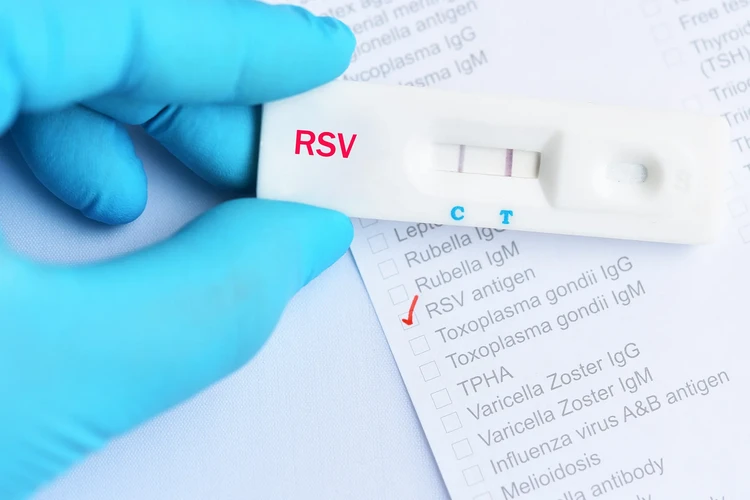 Xét nghiệm RSV: Xét nghiệm kháng nguyên nhanh và rRT-PCR