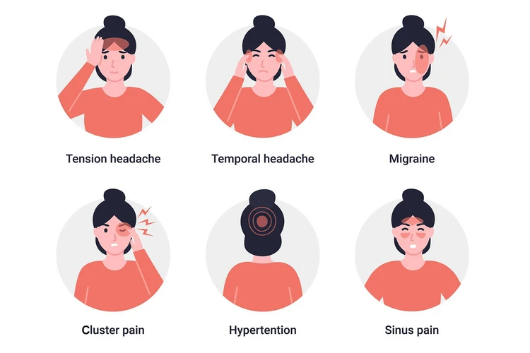 Vị trí đau đầu: Hướng dẫn toàn diện