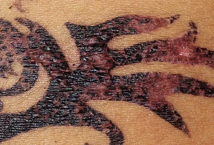 Henna là gì?
