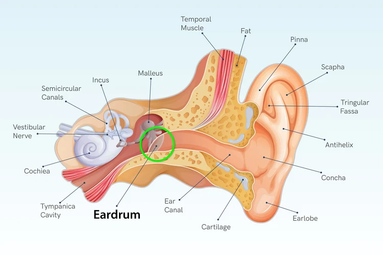 Vỡ màng nhĩ: Triệu chứng và cách điều trị