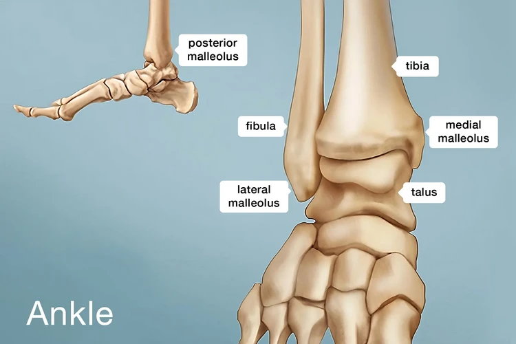 Chấn thương mắt cá chân: Nguyên nhân, cách điều trị và phòng ngừa