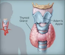 Suy giáp (tuyến giáp hoạt động kém)