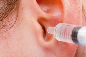 Cách vệ sinh tai của bạn
