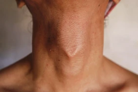 Adams Apple: Nó có làm thay đổi giọng nói của tôi không?