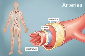 Động mạch bị tắc nghẽn (Mảng bám động mạch)