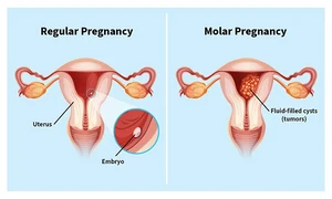 Ong bắp cày giết người