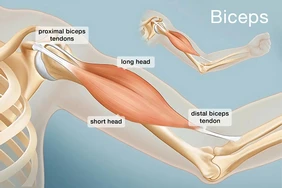 Những điều cần biết về đứt cơ nhị đầu