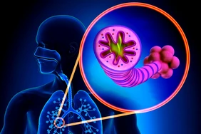 COPD giai đoạn cuối (Giai đoạn IV)